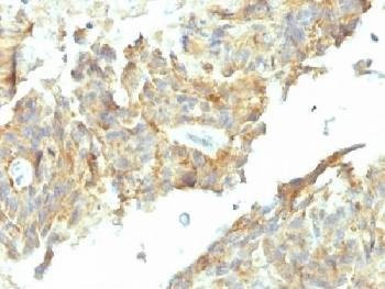 Anti-Alkaline Phosphatase Antibody (tissue-nonspecific)