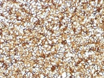 Anti-SPTBN2 / Spectrin beta III Antibody, Sodium Azide Free