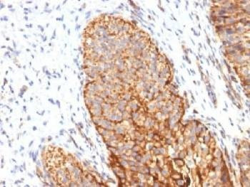 Anti-Thrombomodulin / CD141 Antibody, Sodium Azide Free