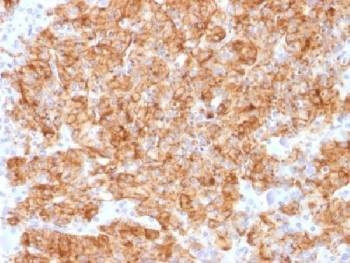 Anti-Chromogranin A Antibody, Sodium Azide Free