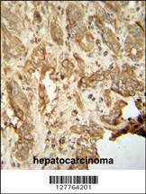 Anti-NAT14 (N-term) Antibody