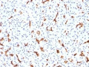 Anti-CFTR Antibody, Sodium Azide Free
