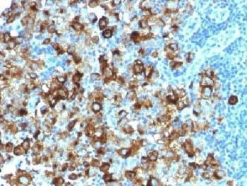 Anti-PMEL17 / Melanoma gp100 Antibody