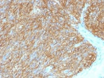 Anti-DOG1 / TMEM16A / ANO1 Antibody, Sodium Azide Free
