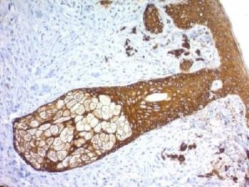 Anti-Basic Cytokeratin Antibody