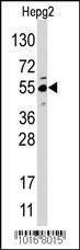 Anti-JMJD4 (N-term) Antibody