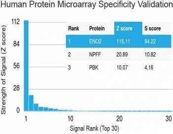 Anti-NSE Antibody
