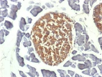 Anti-NSE Antibody, Sodium Azide Free