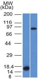 Anti-Factor XIIIa / F13A1 Antibody