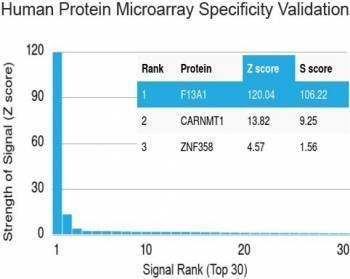 Anti-Factor XIIIa / F13A1 Antibody, Sodium Azide Free