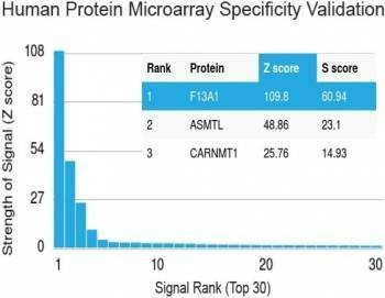 Anti-Factor XIIIa / F13A1 Antibody, Sodium Azide Free
