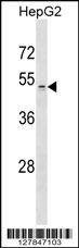 Anti-ZDHHC1 (N-term) Antibody