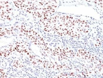Anti-p53 / TP53 Antibody, Sodium Azide Free