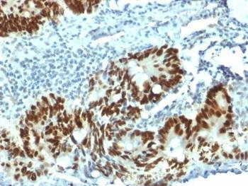 Anti-p53 / TP53 (N-Terminal Region) Antibody