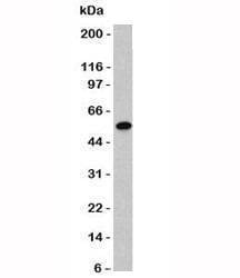 Anti-Vimentin Antibody