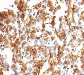 Anti-Vimentin Antibody, Sodium Azide Free