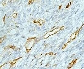 Anti-CD31 Antibody