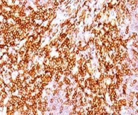 Anti-CD68 Antibody, Sodium Azide Free
