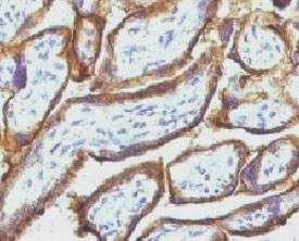 Anti-EGFR Antibody