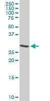Anti-ARPC2 Antibody