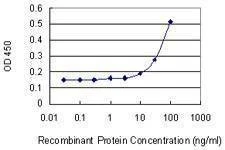 Anti-ARPC2 Antibody
