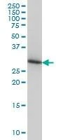 Anti-ARPC2 Antibody