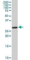 Anti-ARPC2 Antibody