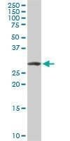Anti-ARPC2 Antibody