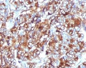 Anti-MUC-1 Antibody