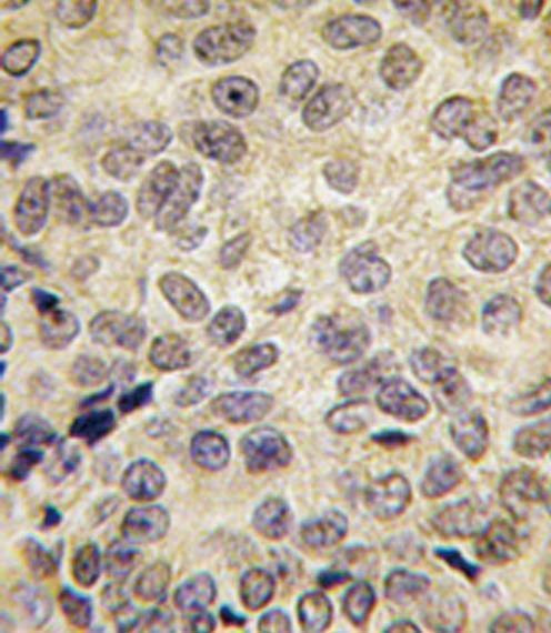 Anti-Dnmt3b Antibody