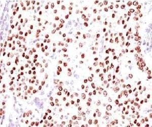 Anti-Progesterone Receptor Antibody