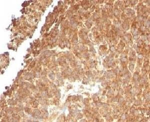 Anti-TOP1MT Antibody