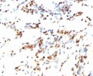 Anti-p27Kip1 Antibody