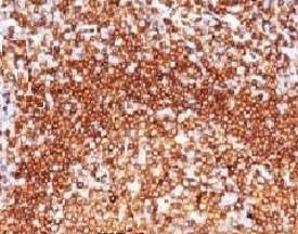 Anti-CD79a Antibody, Sodium Azide Free