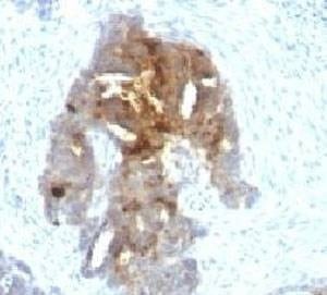 Anti-TAG-72 Antibody, Sodium Azide Free
