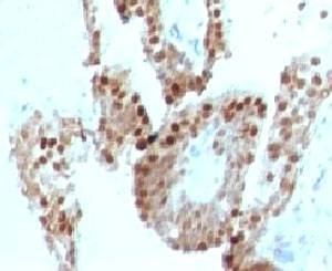Anti-p57 Antibody