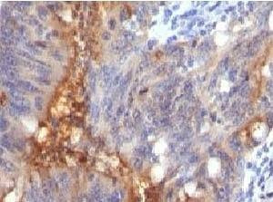 Anti-Secretory Component Glycoprotein Antibody
