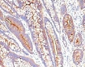 Anti-CEA Antibody, Sodium Azide Free