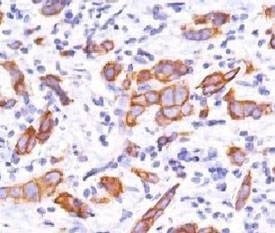 Anti-HER2 Antibody, Sodium Azide Free