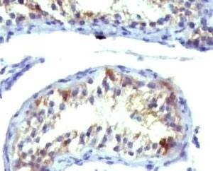 Anti-Prolactin Receptor Antibody