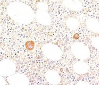 Anti-von Willebrand Factor Antibody, Sodium Azide Free