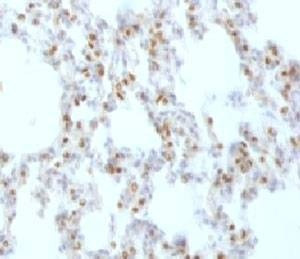 Anti-TTF1 Antibody