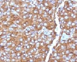 Anti-Chromogranin A Antibody