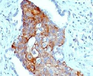 Anti-TRIM29 Antibody, Sodium Azide Free