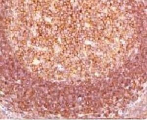 Anti-Bcl10 Antibody, Sodium Azide Free