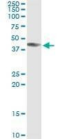 Anti-ART3 Antibody