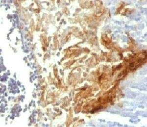 Anti-Involucrin Antibody