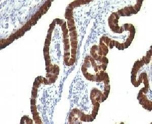 Anti-Cytokeratin 7 Antibody