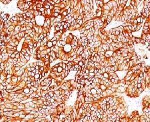 Anti-Cytokeratin 18 Antibody