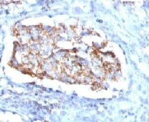 Anti-HSP60 Antibody, Sodium Azide Free